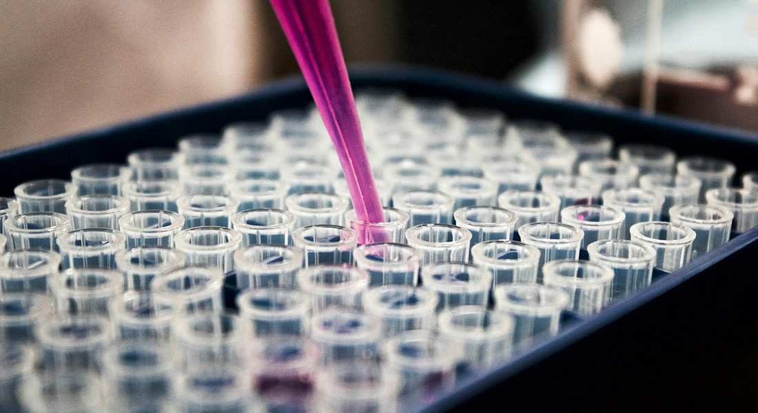 Refill of liquid on tubes by Louis Reed, Unsplash